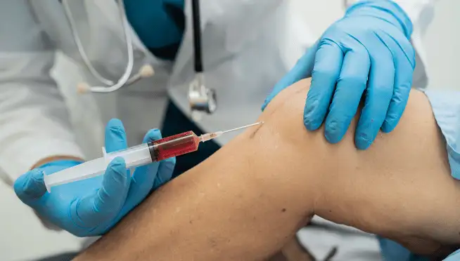 How PRP Injections are performed